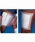 Adhesive Dressing WoundGard 6 X 6 Inch Gauze Square White Sterile 30 Count By MPM Medical