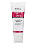 Advanced Clinicals Crepey Skin Care Treatment Body Lotion Crepe Skin Wrinkle Eraser Moisturizer Collagen Cream Vitamin E Cream Arnica Bruise Cream W/Horse Chestnut Fragrance 8 Fl Oz