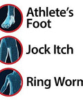 Miconazole Globe (6 Pack) 2 Nitrate 2 Antifungal Cream Cures Most Athletes Foot Jock Itch Ringworm And More 1 Oz Tube