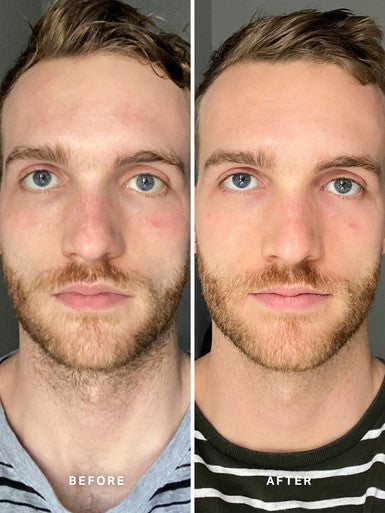 Alpha H Vitamin B Serum with 5% Niacinamide