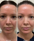 Alpha H Vitamin B Serum with 5% Niacinamide