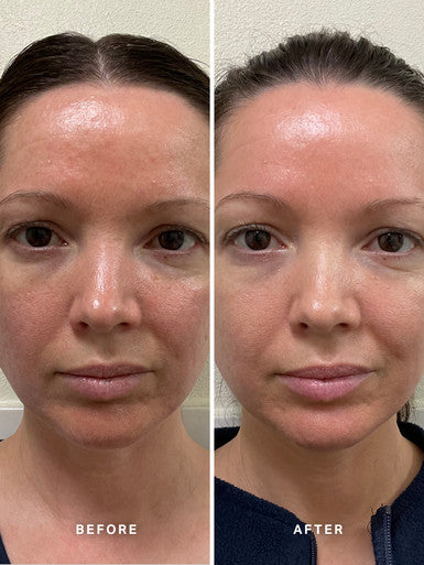 Alpha H Vitamin B Serum with 5% Niacinamide
