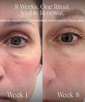 Haroutine Advanced Marine Collagen Peptides Powder + Liposomal Vitamin C Hyaluronic