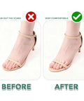 Welnove Gel Ball Of Foot Cushions - Welnove Metatarsal Pads Women Non-Slip Forefoot Cushion Shoes Inserts For Foot Pain Relief Comfort Shock Absorption & All-Day Wear In Sandals High Heels Flats 4 Pairs