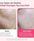 Dr.Melaxin Cemenrete Cyano Pink Spicule Serum With Calcium Vitamin B12 For Under Eyes Skin Dark Circles Fine Lines Puffiness&Eye Bags Cream 1.01 Fl. Oz.