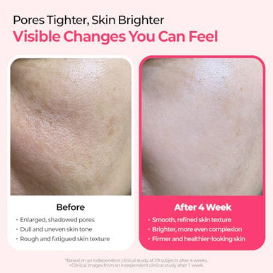 Dr.Melaxin Cemenrete Cyano Pink Spicule Serum With Calcium Vitamin B12 For Under Eyes Skin Dark Circles Fine Lines Puffiness&Eye Bags Cream 1.01 Fl. Oz.