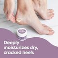 Zentoes Natural Foot Balm Hydrating Cream For Dry Cracked Heels & Feet Enriched With Coconut Tea Tree Jojoba & Vitamin E Oils Soothes & Softens Rough Skin 2Oz