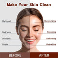 Purederm Coconut Essence Mask (12 Pack) - Coconut Extracts, Collagen, And Vitamin E To Make Your Skin Smooth And Clear