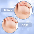 Areola Silicone Scar Sheets For Surgical Scars From Breast Reduction, Augmentation, Lift Or Post Mastectomy - 2 Pack -Reusable And Comfortable Under Post Op Bra