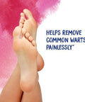 Boiron Thuja Occidentalis 30C Homeopathic Medicine For Painless Wart Removal Medicine 80 Pellets