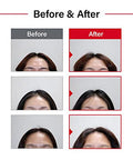 Dr.Forhair Scalp Strengthening Folligen Shampoo 750 Ml/16.91 Fl. Oz. Hair Strengthening Shampoo With Biotin And Ceramide No.1 Korean Scalp Care For Thinning Hair Hypoallergenic