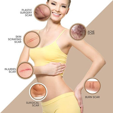 Frankos Medical Grade Silicone Scar Tape - 1.6" X 120" Roll-3M - Soft Scar Sheets For For All Scars Including C-Section, Tummy Tuck, Keloid, Acne, Burn, Injury, Surgical Scars, And More.