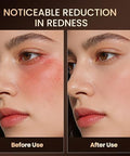 Memtim Red Light Therapy Mask For Face 4 Modes Cordless Led Face Mask Light Therapy With 2000Mah Rechargeable Remote Led Face Mask At Home& Travel