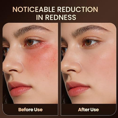 Memtim Red Light Therapy Mask For Face 4 Modes Cordless Led Face Mask Light Therapy With 2000Mah Rechargeable Remote Led Face Mask At Home& Travel
