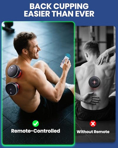 Eurpmask Choose The Color Of Europe Electric Cupping Kit For Massage Therapy With Remote Controller - 32 Levels Of Adjustable Suction & Heat Portable Cupping Therapy Set For Back Pain Relief Neck Muscle Soreness