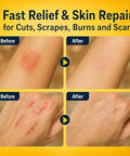 Manuka Honey for Wounds, Wound Healing Ointment for Cuts, Scrapes, Burns, Foot Ulcers and Scars, Fast Relief & Skin Repair, Non-Sticky, No Crystallization, 1.06 oz