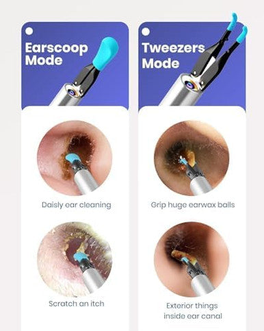 Bebird Note 5 Ear Camera Wax Removal Ear Wax Removal Tool Camera Ear Tweezers With Camera 10 Megapixels Ear Otoscope Camera 12 Ear Spoon Ear Cleaner With Camera For Earwax Cleaning