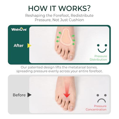 Welnove Metatarsal Pads For Women Men - T-Shape - Leather Ball-Of-Foot Honeycomb Cushions - Soft Ball Of Foot Pads For Metatarsalgia Morton S Neuroma Fit For High Heels Shoes - Gray 4 Pairs