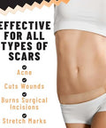 Tolevita Silicone Scar Patches Silicone Gel Sheets For Scars Acne Surgery Keloid Scar Removal And Stretch Marks Gentle Scar Care And Fading 5 Sheets