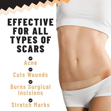 Tolevita Silicone Scar Patches Silicone Gel Sheets For Scars Acne Surgery Keloid Scar Removal And Stretch Marks Gentle Scar Care And Fading 5 Sheets