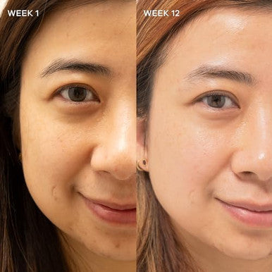 Vida Glow Collagen Liquid Advance Mixed Bery Flavour 15 X 12.4Ml Liquid Sachets Net 186Ml 1 Serve = 5000Mg Of Collagen