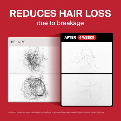 Dr.Forhair Folligen Thickening Scalp Conditioning Mask 6.76 Oz Root-To-Tip Nourishing Care Biotin Keratin & Peptides Scalp & Hair Treatment Reduces Breakage Helps Create Thicker Fuller-Looking Hair