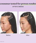 Lemme Grow Hair Growth Supplement For Women Clinically Proven Keratin Complex For Visibly Thicker Hair And Scalp Coverage Reduced Shedding Nourish Thinning Hair 1 Month Supply