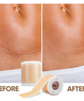 Frankos Medical Grade Silicone Scar Tape - 1.6" X 120" Roll-3M - Soft Scar Sheets For For All Scars Including C-Section, Tummy Tuck, Keloid, Acne, Burn, Injury, Surgical Scars, And More.