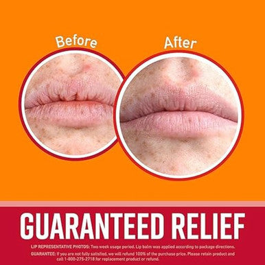 Lip Balm Lip Repair Cherry & Vitamin E Oil 0.15 Oz (4.2 G) O'Keeffe'S