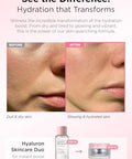 Hanskin Real Complexion Hyaluronic Moisture Cream Hyaluronic Acid Moisturizer With Niacinamide Vitamin E Moisturizing Lotion For Sensitive And Dry Skin Korean Skincare 1.69 Fl.Oz.