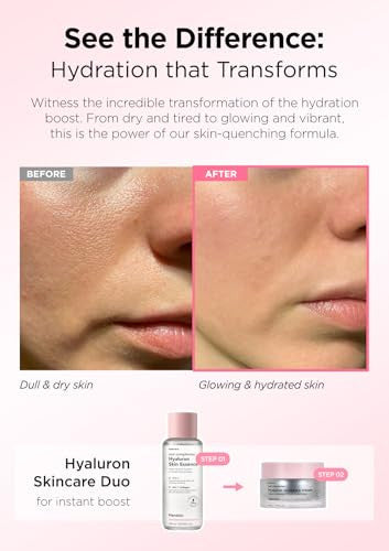 Hanskin Real Complexion Hyaluronic Moisture Cream Hyaluronic Acid Moisturizer With Niacinamide Vitamin E Moisturizing Lotion For Sensitive And Dry Skin Korean Skincare 1.69 Fl.Oz.