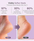 Zentoes Natural Foot Balm Hydrating Cream For Dry Cracked Heels & Feet Enriched With Coconut Tea Tree Jojoba & Vitamin E Oils Soothes & Softens Rough Skin 2Oz