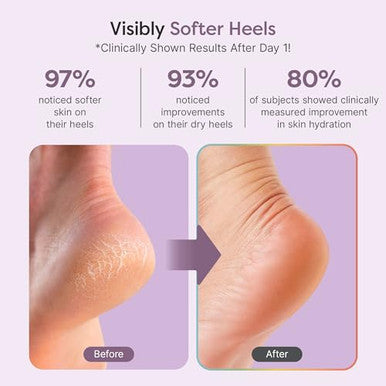 Zentoes Natural Foot Balm Hydrating Cream For Dry Cracked Heels & Feet Enriched With Coconut Tea Tree Jojoba & Vitamin E Oils Soothes & Softens Rough Skin 2Oz