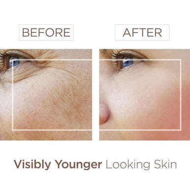 Bee And You Vitamin C Face Serum Moisturizing Anti Aging Reduce The Appearance Of Dark Spots Glow Up Skin Brightener With Propolis Vitamin E & Ferulic Acid ÃƒÂ¢Ã¢â€šÂ¬Ã¢â‚¬Å“ 1 Fl Oz