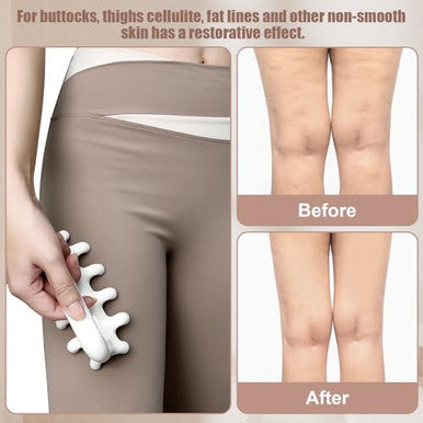 Vemoky Fascia Massage Tool Trigger Point Massage Tools Anti Blaster For Cellulite Massage Tool Reaching Deep Myofascial Tissue Throughout The Body Release Muscle Knot Reduction Cellulite