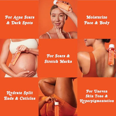 Biooil Skincare Body Oil Serum For Scars And Stretch Marks Face And Body Moisturizer With Vitamin E & A For Sensitive Dry Skin Dermatologist Recommended Travel Size .85 Oz Pack Of 3