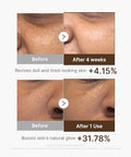 Medicube Deep Vita C Capsule Serum & Cream Duo: Liposome Vita C Capsule Serum And Vita C Capsule Cream | Hydrating Vitamin C Capusle For Dull Uneven-Looking Skin