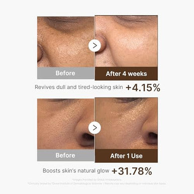 Medicube Deep Vita C Capsule Serum & Cream Duo: Liposome Vita C Capsule Serum And Vita C Capsule Cream | Hydrating Vitamin C Capusle For Dull Uneven-Looking Skin