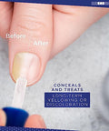 Blossom All Natural Organic Acetone Nail Polish Remover + Blue Cross Optical Nail Whitener Nail Brightening Basecoat With Vitamin E 2 Pack Bundle