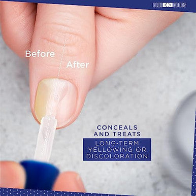 Blossom All Natural Organic Acetone Nail Polish Remover + Blue Cross Optical Nail Whitener Nail Brightening Basecoat With Vitamin E 2 Pack Bundle