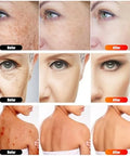 Gyp 7 In 1 Portable Light Therapy For Face For Body Lamp With Stand 920Nm Red Infrared Light Therapy Device Led Face Skin Body Skin Care At Home