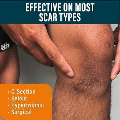 Nuvadermis Extra Long Silicone Scar Sheets With Scar Gel Reusable Medical Grade Sheets For C-Section, Tummy Tuck, Keloid, And Surgical Scars