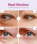 Dr.Melaxin Cemenrete Calcium Volume Eye Patch 60Ea
