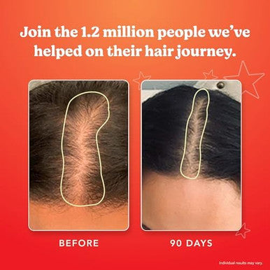 HAIRtamin Gummy Stars Hair Vitamins with Biotin Month Supply