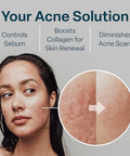 Qrxlabs Glycolic + Salicylic Acid Acne Control Pads With 10% Ultra Pure Glycolic & 2% Salicylic Allantoin Vitamin B5 C & E Calendula & Green Tea - Acne Treatment For Clear Skin