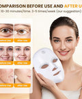 Musewish Red Light Therapy For Face7-1 Colors Led Facial Skin Care Mask Red Light Mask For Face Infrared Light Mask Anti-Aging Wrinkle Acne Rechargeable Portable Home & Travel