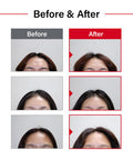 Dr.FORHAIR Folligen Original AntiThinning Biotin Shampoo 16.9 oz Hair Regrowth Thickening Anti Hair Loss