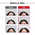 Dr.FORHAIR Folligen Original AntiThinning Biotin Shampoo 16.9 oz Hair Regrowth Thickening Anti Hair Loss