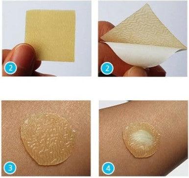 Duo.derm 187955 Extra Thin CGF Dressings 4 X 4 Inches ,10 Count from CHLIFE