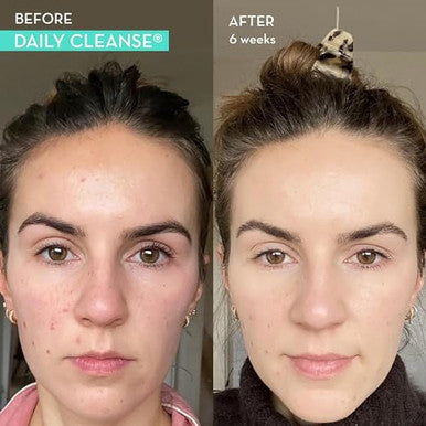Hum Daily Cleanse Acne Supplement Gut Cleanse Detox For Clear Skin With Organic Algae Detoxifying Herbs Zinc & Spirulinaclear Skin Supplement (60 Capsules)
